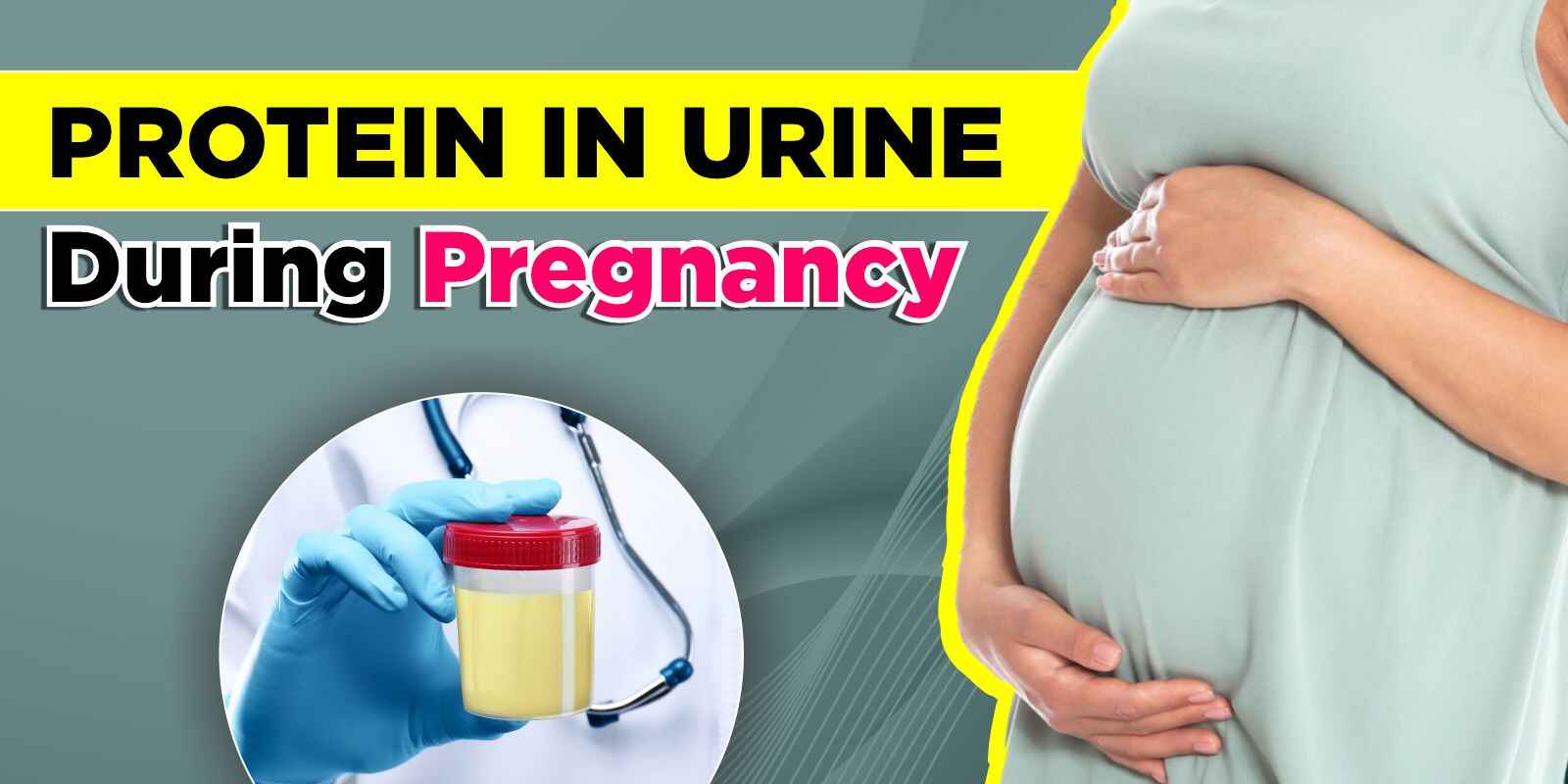 Protein in Urine During Pregnancy